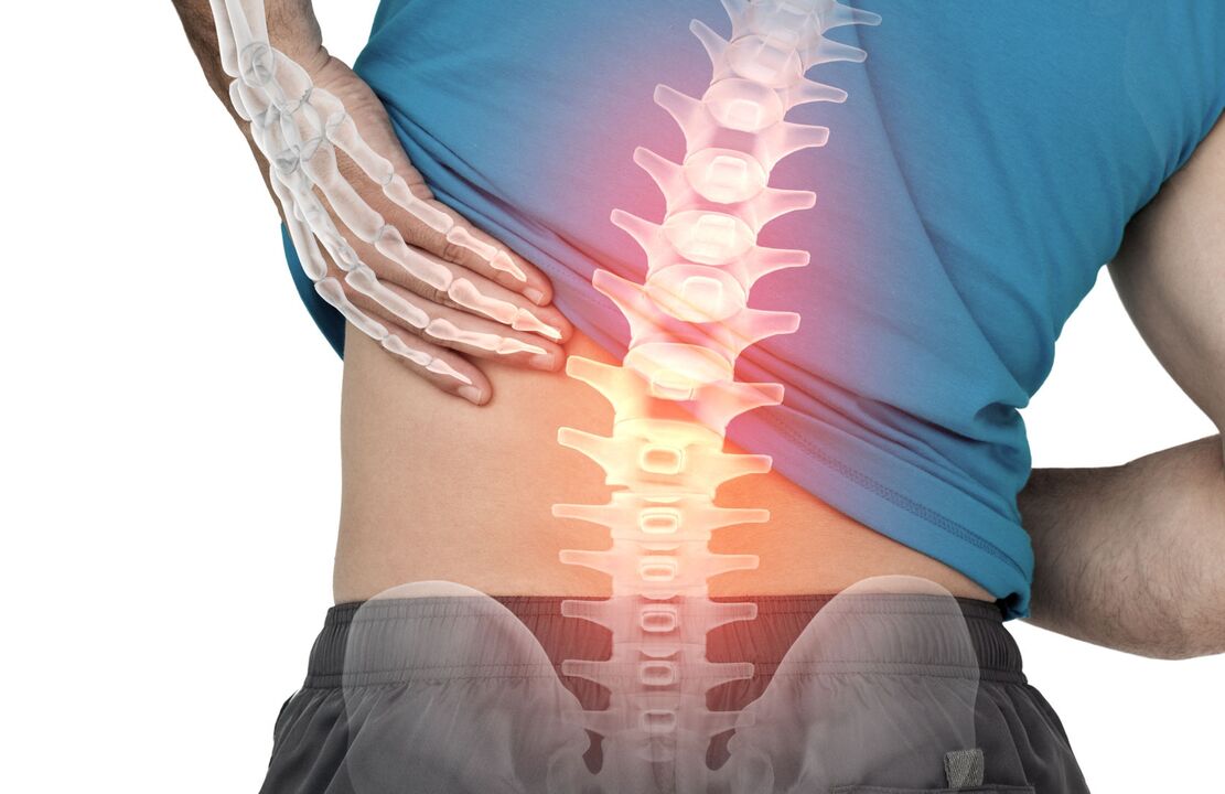 The risk of ostechondrosis of the lumbar spine