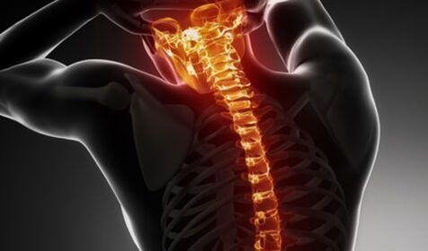 Osteochondrosis of the entire spine