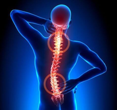 Osteochondrosis of the spine