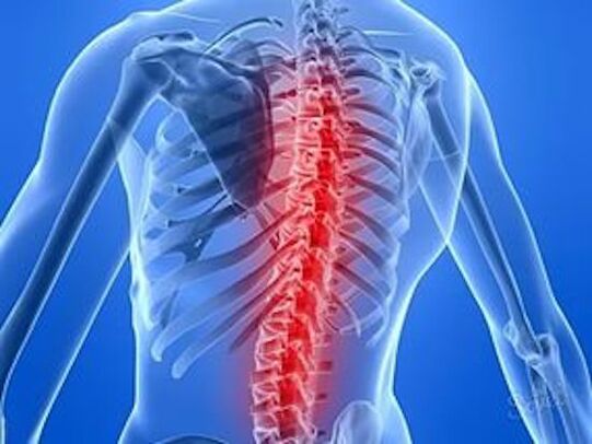 Spinal diseases cause back pain